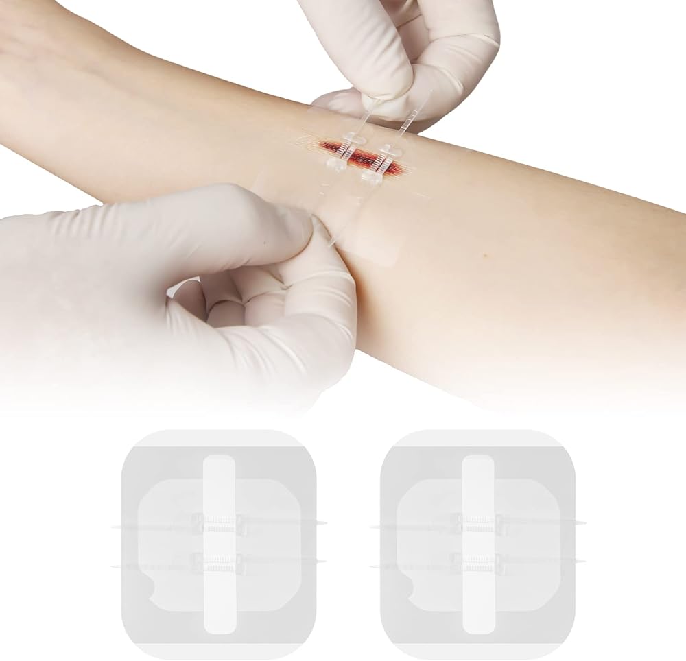 Refill Kits